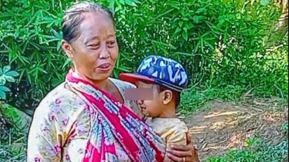 Tak Ada Biaya untuk Berobat, Bola Mata Dimas, Balita di Ponorogo Alami Pembengkakan hingga Nyaris Lepas