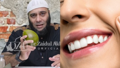Gigi Putih Sehat Tanpa Pasta Gigi, Rahasianya Cukup Pakai Bahan Hitam Ini Kata dr Zaidul Akbar