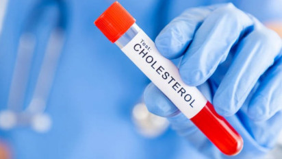 3 Obat Kolesterol Ampuh dan Harga Terjangkau yang Ada di Apotek