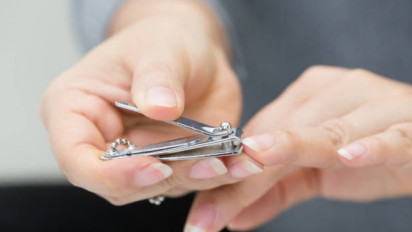 Hukum Memotong Kuku dan Rambut Sebelum Berkurban Saat Idul Adha Menurut Buya Yahya Ternyata Hal itu...