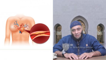 Kolesterol Jahat Bisa Minggat Tanpa Berobat ke Dokter, Dr Zaidul Akbar Jelaskan Cara Kerjanya 