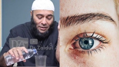 Mata Panda Luntur dan Ginjal Seketika Bersih, Coba Minum Cairan Rebusan Bahan Ini Kata dr Zaidul Akbar