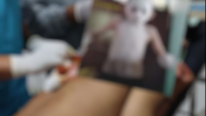 Pemuda di Pringsewu Lampung Dibacok Orang Tak Dikenal, Alami Luka Sayatan di Punggung Hingga 40 Jahitan