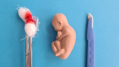 Akses Aborsi Legal Bagi Korban Kekerasan Masih PR Besar, KemenPPPA: Fasilitas Kesehatan dan Nakes Belum Siap