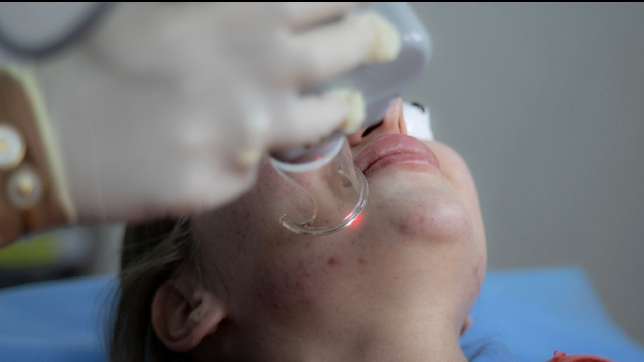 Ingin Perawatan Bekas Luka dan Jerawat yang Sulit Dijangkau? Simak Caranya Berikut
            - galeri foto