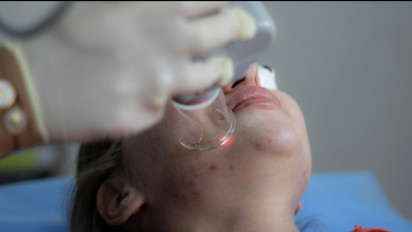 Ingin Perawatan Bekas Luka dan Jerawat yang Sulit Dijangkau? Simak Caranya Berikut