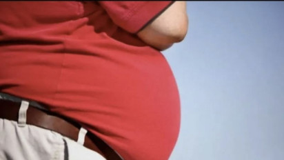 Apa Risiko Kegemukan, Dokter Ingatkan Hal Ini