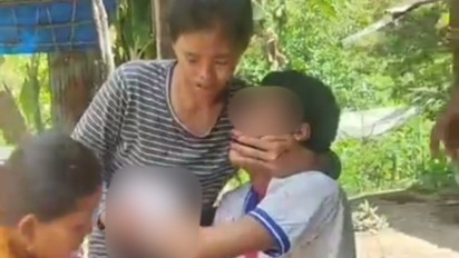 Kasihan! Sedang Jualan Madu di Pinggir Jalan, Siswa SMA Ini Malah Dibegal, Wajah dan Tangan Disayat