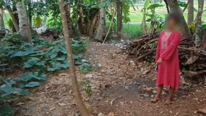 Bocah Terbakar di Kabupaten Semarang Dapat Pendampingan Psikologis