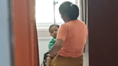 Sempat Demam Kondisi Bayi Kembar Siam Kaki Empat Membaik, Jadwal Operasi Masih Belum Ditentukan