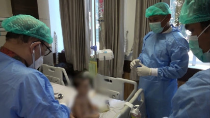 Tim Dokter Ahli Bersiap Lakukan Operasi Pemisahan Kembar Siam Kaki Empat Langka Sabtu Besok