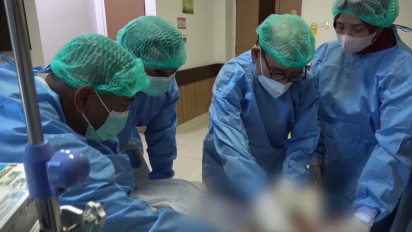 Hari ini, Tim Dokter RSUD NTB Berjuang Pisahkan Kembar Siam Berkaki Empat