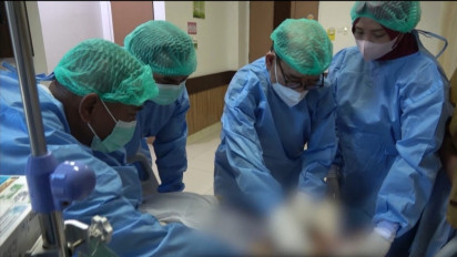 Alhamdulillah, Bayi Kembar Siam Kaki Empat Berhasil Dipisahkan, RSUP NTB Deklarasi Jadi Rujukan Kembar Siam