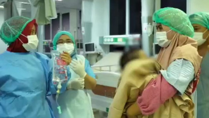 Begini Kondisi Bayi Kembar Siam Kaki Empat Pasca Operasi Pemisahan