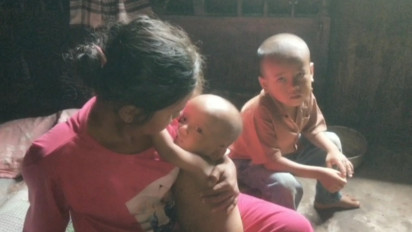 Dinas Kesehatan Mengaku Kasus Gizi Buruk di Padang Lawas Sudah Bisa Diatasi