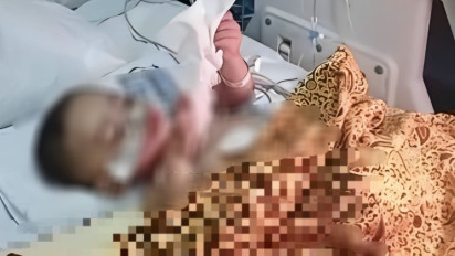 Bayi Kembar Siam Berkaki Empat Muhammad Karunia Sudah Mulai Bermain dengan Ibunya
