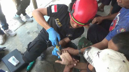 Tersangkut di Jari Selama 3 Tahun, Evakuasi Cincin dari Tangan ODGJ asal Tuban Berlangsung Dramatis