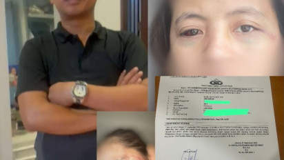 Oknum Anggota DPRD Dilapor Aniaya Pacarnya di Sebuah Apartemen di Jakarta Selatan