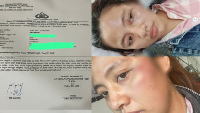 Update Oknum Anggota DPRD Aniaya Pacar di Apartemen, WEP : "Saya Mau Berdamai", AG : "Saya Pikir-Pikir Dahulu"