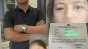 Update Kasus Perempuan Dianiaya Anggota DPRD Takalar di Apartemen Jaksel, Ini Kata Polisi