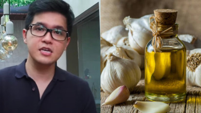 Tadinya Mau Pasang Ring di Jantung, Seketika Batal karena Konsumsi Ramuan Bawang Putih, Kok Bisa? dr Vito Damay Bilang...