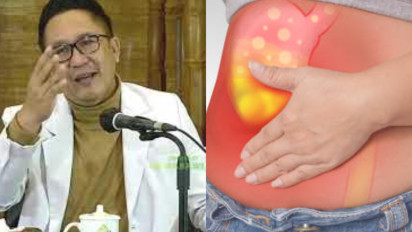 Dua Jenis Makanan Ini Memang Enak Disantap tapi Tolong Jangan Terlalu Banyak! dr Cahyono Bilang itu Bikin Usus jadi Lengket dan kotor