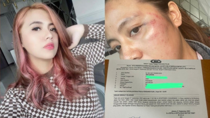 Update Anggota DPRD Takalar Aniaya Pacarnya, Korban : Pelaku Minta  Cabut Laporan tapi ....