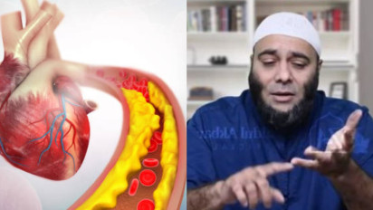 5 Cara Mudah Turunkan Tekanan Darah Tinggi ala dr Zaidul Akbar, Salah Satunya Cukup Jalan Kaki Tiga Menit Sehari