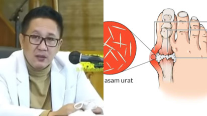 Jangan Capek Ikhtiar! Anda yang Menderita Diabetes, Sakit Dada, Asam Urat Coba Ikuti Nasihat dr Cahyono ini, Insya Allah Penyakit-penyakit itu Musnah, Asalkan...