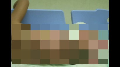 Balita Tercemplung Panci Sayur Panas, Ini Penjelasan Dokter Jaga IGD RSUD dr Harjono Ponorogo