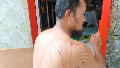 Kisah Nelayan Selamat dari Serangan Buaya Muara di Tanjungpinang