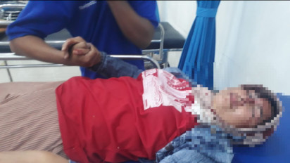 Sadis, Seorang Emak di Probolinggo Dibegal, Motor Dirampas, Dibacok dan Dikencingi Pelaku