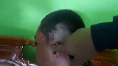 Tegur Keributan Tengah Malam, Bocah 15 Tahun Diduga Dianiaya Oknum Caleg