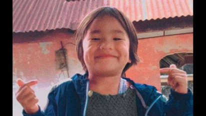 Kisah Pilu Amora Bocah Asal Sidamanik Meninggal Karena Luka Bakar, Diduga Korban Malpraktik Sempat Pulih Usai Operasi