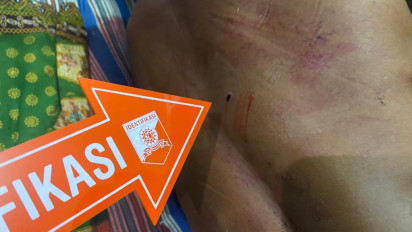 Pria Paruh Baya di Jambi Tewas Akibat Luka Tembak