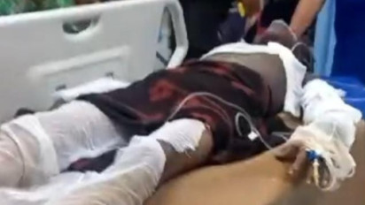 Dituduh Curi Handphone, Seorang Pria di Medan Dibakar Massa