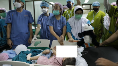 Bayi Kembar Siam Hasan-Husein Berhasil Dipisahkan, Sayang Hasan Tak Mampu Melewati Masa Kritis