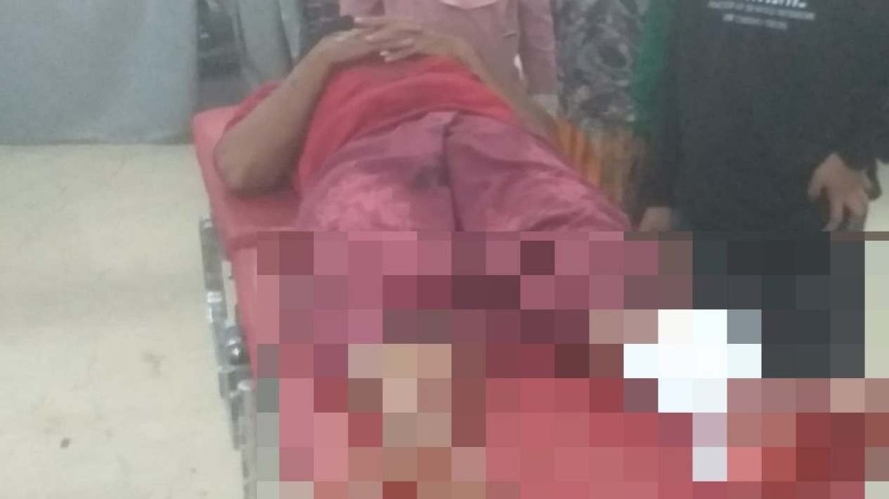 Melawan Tiga Begal, Warga Probolinggo Dibacok Hingga Kritis
            - galeri foto