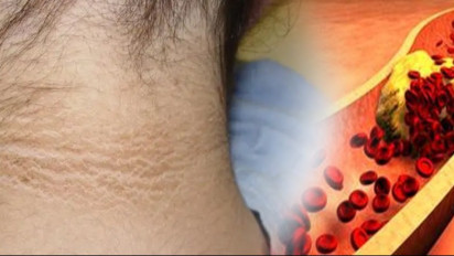 Tolong Bedakan! Bentuknya Mirip Daki 'Numplek', Ternyata Bercak Hitam ini Tanda Penyakit Mematikan