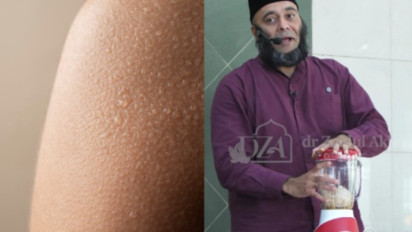 Ibu-ibu Tak Usah Pakai Skincare dan Makeup Lagi, Lakukan Ini Saja Kata dr Zaidul Akbar, Wajah Auto Glowing Alami