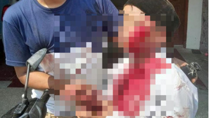 Kasus Dugaan Penganiayaan Sayat Pipi Siswa MI Dau di Malang, Polisi Lakukan Penyelidikan