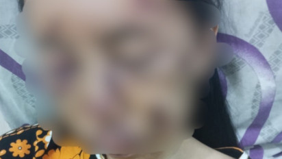 Sadis! Begal Kembali Merajalela, Rampas Motor Ibu dan Anak hingga Terluka Parah 