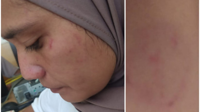 Buat Keributan Karena Anak Melapor Dirinya Dibully, Orang Tua Murid Malah Aniaya Guru