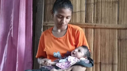 Ibunda Makan Ubi dan Pisang Setiap Hari, Balita 11 Bulan Alami Gizi Buruk 