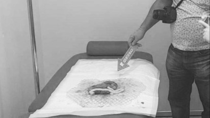 Gugurkan Kandungan Hasil Hubungan Gelap, Karyawati di Batam Terancam 20 Tahun Penjara