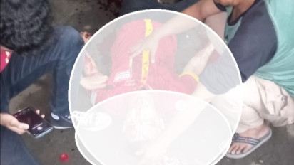 Karyawan Minimarket di Bekasi Jadi Korban Bacok Perampok, Polisi: Tangan Korban Nyaris Putus