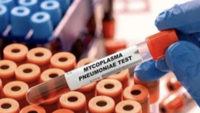 Kabar Buruk! Masa Covid-19 Belum Selesai Muncul Kasus Pneumonia di Jakarta, Kemenkes Desak Masyarakat Gunakan Masker