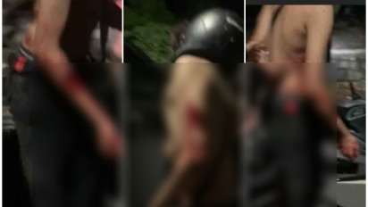 Nahas! Seorang Remaja di Bojonegoro Jadi Korban Pengeroyokan dan Pembacokan