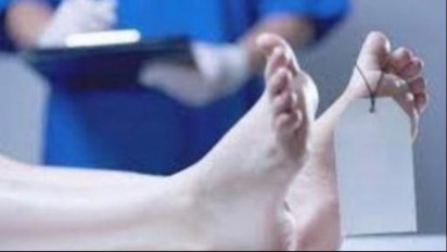 Buntut Mayat UNPRI, Ahli Forensik: Kadaver Harusnya Tidak Dipertontonkan ke Khalayak Ramai Apalagi Diviralkan