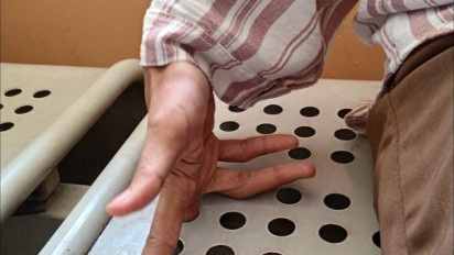 Jari Mahasiswi UIN Yogyakarta Ini Terjepit Kursi, Petugas Damkar Turun Tangan